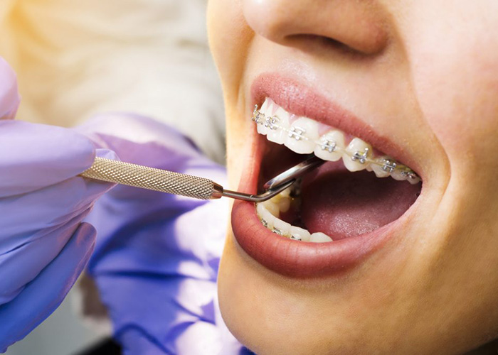 Orthodontics Reston Va